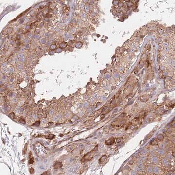 Anti-RNF19B antibody produced in rabbit Prestige Antibodies&#174; Powered by Atlas Antibodies, affinity isolated antibody, buffered aqueous glycerol solution