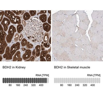 Anti-BDH2 antibody produced in rabbit Prestige Antibodies&#174; Powered by Atlas Antibodies, affinity isolated antibody, buffered aqueous glycerol solution