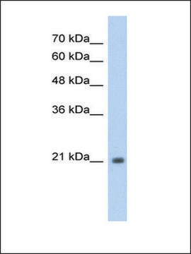 Anti-TSHR antibody produced in rabbit IgG fraction of antiserum