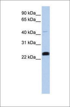 Anti-LYCAT affinity isolated antibody