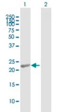 Anti-RCVRN antibody produced in mouse purified immunoglobulin, buffered aqueous solution