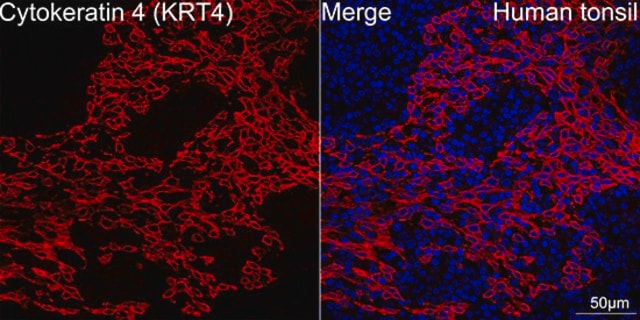 Anti-Cytokeratin 4 (KRT4) Antibody, clone 6H9R6, Rabbit Monoclonal