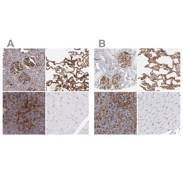 抗ICAM1 ウサギ宿主抗体 Prestige Antibodies&#174; Powered by Atlas Antibodies, affinity isolated antibody, buffered aqueous glycerol solution