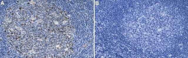 Anti-LAG3 Antibody, clone 1B14-H1 ZooMAb&#174; Rabbit Monoclonal recombinant, expressed in HEK 293 cells