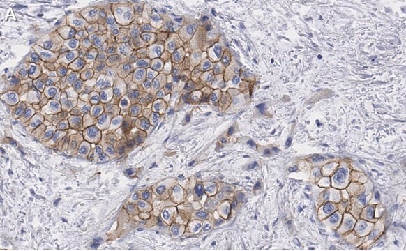 Anti-Glypican-1 Antibody, clone 1J4, ZooMAb&#174; Rabbit Monoclonal recombinant, expressed in HEK 293 cells