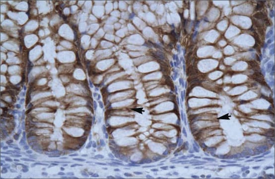 Anti-SUV39H1 antibody produced in rabbit IgG fraction of antiserum