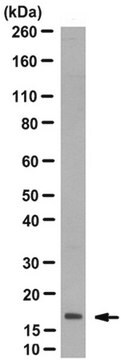 Anti-LIMD2 Antibody, clone 18.30 clone 18.30, from mouse | Sigma-Aldrich