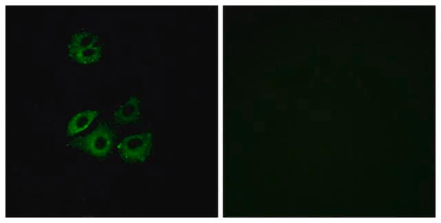 Anti-CCBP2 antibody produced in rabbit affinity isolated antibody