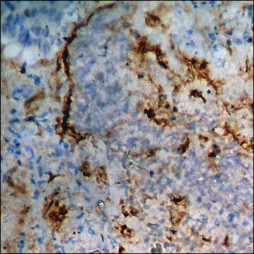 Anti-phospho-Calcium Sensing Receptor (pThr888) antibody produced in rabbit affinity isolated antibody