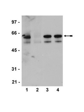 抗磷酸化-Src家族（Tyr416）抗体，克隆2N8，兔单克隆 clone 2N8, Upstate&#174;, from rabbit