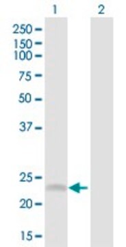 Anti-SRD5A1 antibody produced in rabbit purified immunoglobulin, buffered aqueous solution