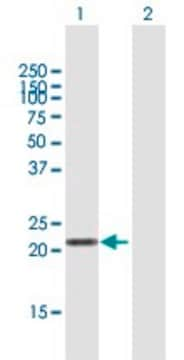 Anti-LVRN antibody produced in mouse purified immunoglobulin, buffered aqueous solution