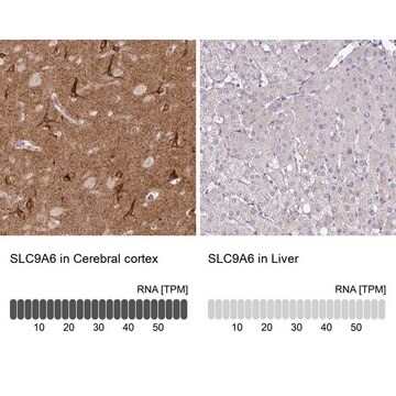 Anti-SLC9A6 antibody produced in rabbit Prestige Antibodies&#174; Powered by Atlas Antibodies, affinity isolated antibody, buffered aqueous glycerol solution