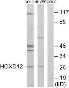 Anti-HOXD12 antibody produced in rabbit affinity isolated antibody