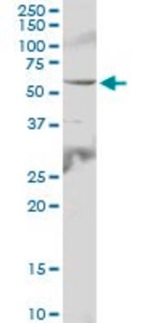 Anti-IL6R antibody produced in mouse purified immunoglobulin, buffered aqueous solution