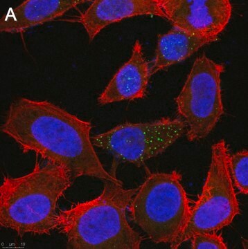 Anti-Tie-2 Antibody, clone 1C5 ZooMAb&#174; Rabbit Monoclonal recombinant, expressed in HEK 293 cells