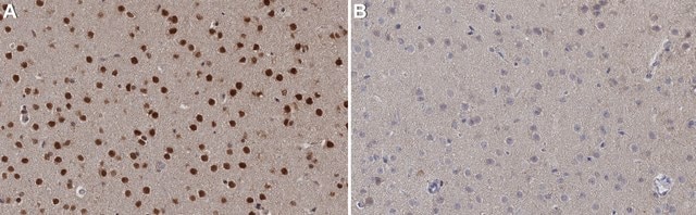 Anticorps anti-Tbr2 from chicken, purified by affinity chromatography