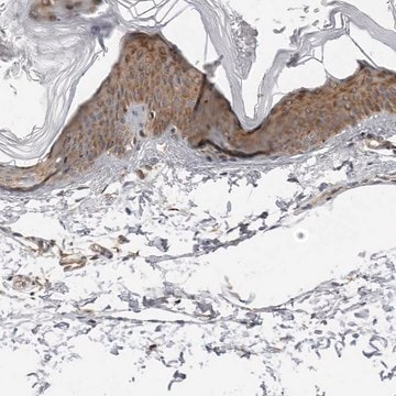 Anti-SRGAP2 antibody produced in rabbit Prestige Antibodies&#174; Powered by Atlas Antibodies, affinity isolated antibody, buffered aqueous glycerol solution, ab1