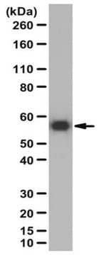 Anti-VEGF-D Antibody 1&#160;mg/mL, from rabbit