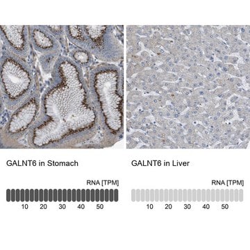 Anti-GALNT6 antibody produced in rabbit Prestige Antibodies&#174; Powered by Atlas Antibodies, affinity isolated antibody, buffered aqueous glycerol solution