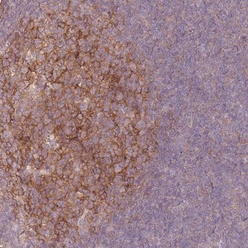 Anti-RFTN1 antibody produced in rabbit Prestige Antibodies&#174; Powered by Atlas Antibodies, affinity isolated antibody, buffered aqueous glycerol solution