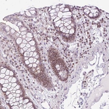 Anti-CCDC137 antibody produced in rabbit Prestige Antibodies&#174; Powered by Atlas Antibodies, affinity isolated antibody, buffered aqueous glycerol solution