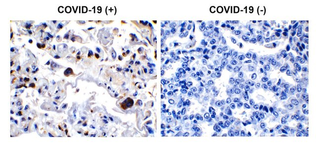 Anti-SARS-CoV-2 (COVID-19) 3CL-PRO (NSP5) antibody produced in rabbit affinity isolated antibody