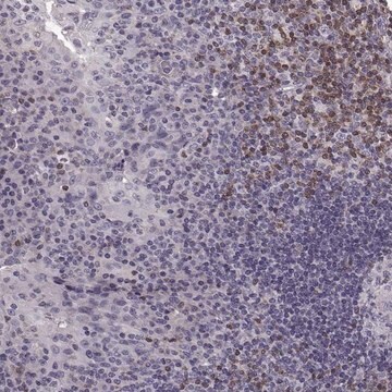 Anti-CDC42SE1 antibody produced in rabbit Prestige Antibodies&#174; Powered by Atlas Antibodies, affinity isolated antibody, buffered aqueous glycerol solution