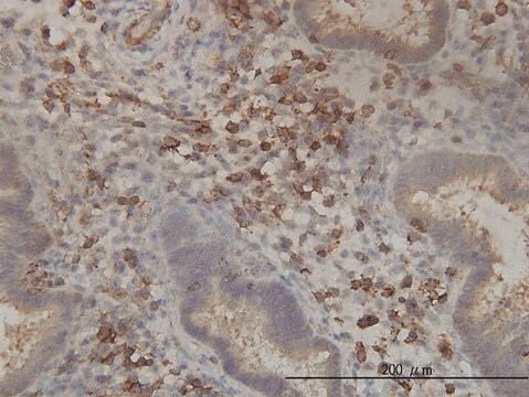 Monoclonal Anti-PANK2 antibody produced in mouse clone 2B12, purified immunoglobulin, buffered aqueous solution