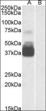 Anti-P2RX7 (N-terminal) antibody produced in goat affinity isolated antibody, buffered aqueous solution