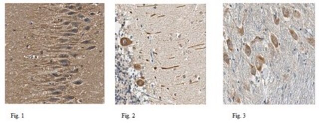 Anti-LRRC4 Antibody from rabbit, purified by affinity chromatography