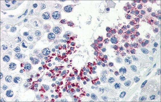 Anti-KLB affinity isolated antibody