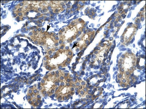 Anti-SP140 antibody produced in rabbit IgG fraction of antiserum