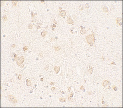 Anti-ULK4 antibody produced in rabbit affinity isolated antibody