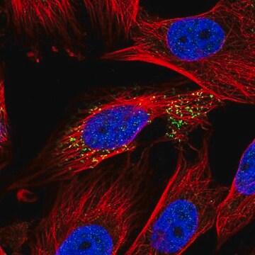 Anti-ABHD14A antibody produced in rabbit Prestige Antibodies&#174; Powered by Atlas Antibodies, affinity isolated antibody