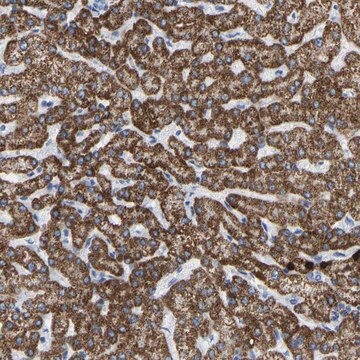 Anti-ZNF629 antibody produced in rabbit Prestige Antibodies&#174; Powered by Atlas Antibodies, affinity isolated antibody, buffered aqueous glycerol solution