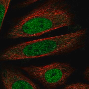 Anti-Rnf20 Antibody Produced In Rabbit Prestige Antibodies&#174; Powered by Atlas Antibodies, affinity isolated antibody, buffered aqueous glycerol solution