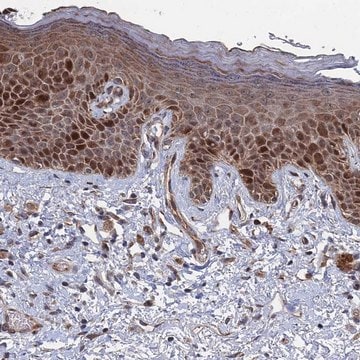 Anti-GTF2IRD1 antibody produced in rabbit Prestige Antibodies&#174; Powered by Atlas Antibodies, affinity isolated antibody, buffered aqueous glycerol solution