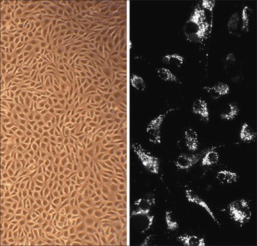 Endothelzellen der Rinderaorta: BAOEC (Cryovial)