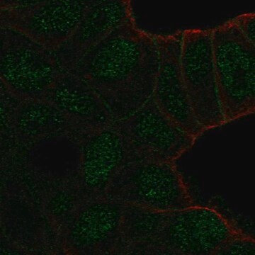 Anti-TBC1D10A antibody produced in rabbit Prestige Antibodies&#174; Powered by Atlas Antibodies, affinity isolated antibody