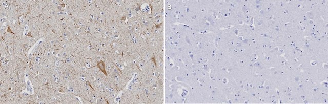 Anti-Dopamine D1 receptor Antibody, clone 2L4 ZooMAb&#174; Rabbit Monoclonal recombinant, expressed in HEK 293 cells