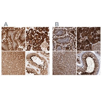 Anti-PCYT2 antibody produced in rabbit Prestige Antibodies&#174; Powered by Atlas Antibodies, affinity isolated antibody, buffered aqueous glycerol solution, Ab2