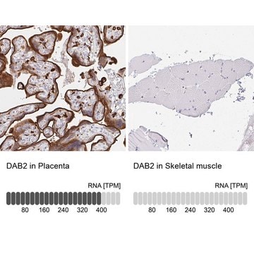 抗DAB2 ウサギ宿主抗体 Prestige Antibodies&#174; Powered by Atlas Antibodies, affinity isolated antibody, buffered aqueous glycerol solution