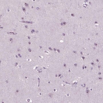 Anti-ZNF853 antibody produced in rabbit Prestige Antibodies&#174; Powered by Atlas Antibodies, affinity isolated antibody, buffered aqueous glycerol solution