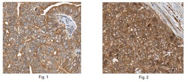 Anti-TRPM8 Antibody from rabbit, purified by affinity chromatography