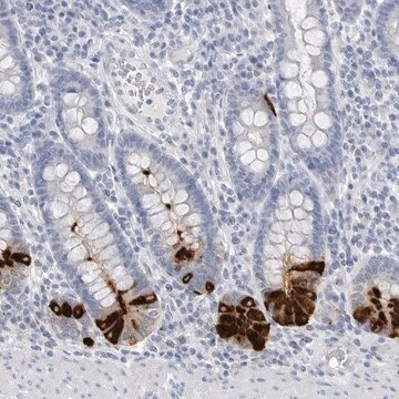 Anti-ABHD12 antibody produced in rabbit Prestige Antibodies&#174; Powered by Atlas Antibodies, affinity isolated antibody, buffered aqueous glycerol solution