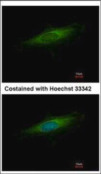 Anti-LAMP3 antibody produced in rabbit affinity isolated antibody, buffered aqueous solution