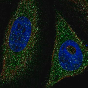 Anti-Tfeb Antibody Produced In Rabbit Prestige Antibodies&#174; Powered by Atlas Antibodies, affinity isolated antibody, buffered aqueous glycerol solution