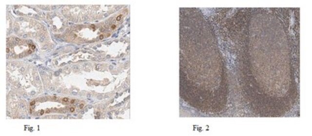 Anti-IKKa (p45) Antibody, clone 881H3 clone 881H3, from mouse