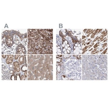 Anti-COQ3 antibody produced in rabbit Prestige Antibodies&#174; Powered by Atlas Antibodies, affinity isolated antibody, buffered aqueous glycerol solution, ab1